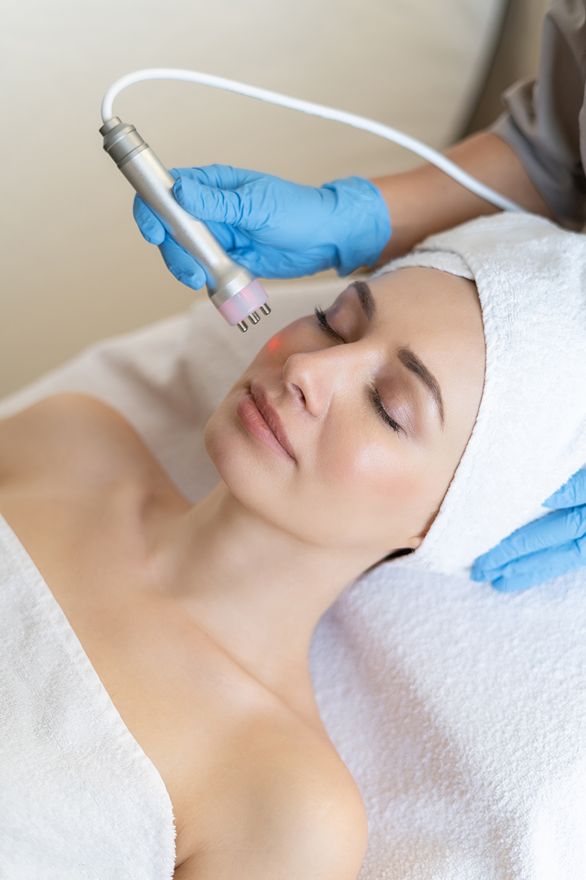 Microneedling Hover