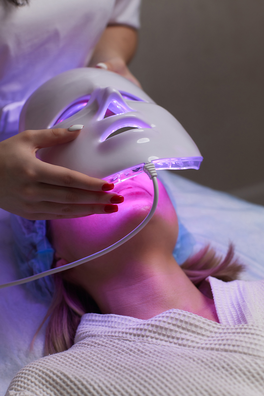 Microneedling Hover