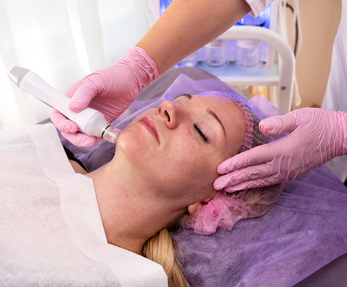 Hydrodermabrasion Melbourne – Deep Cleansing Facial Treatment